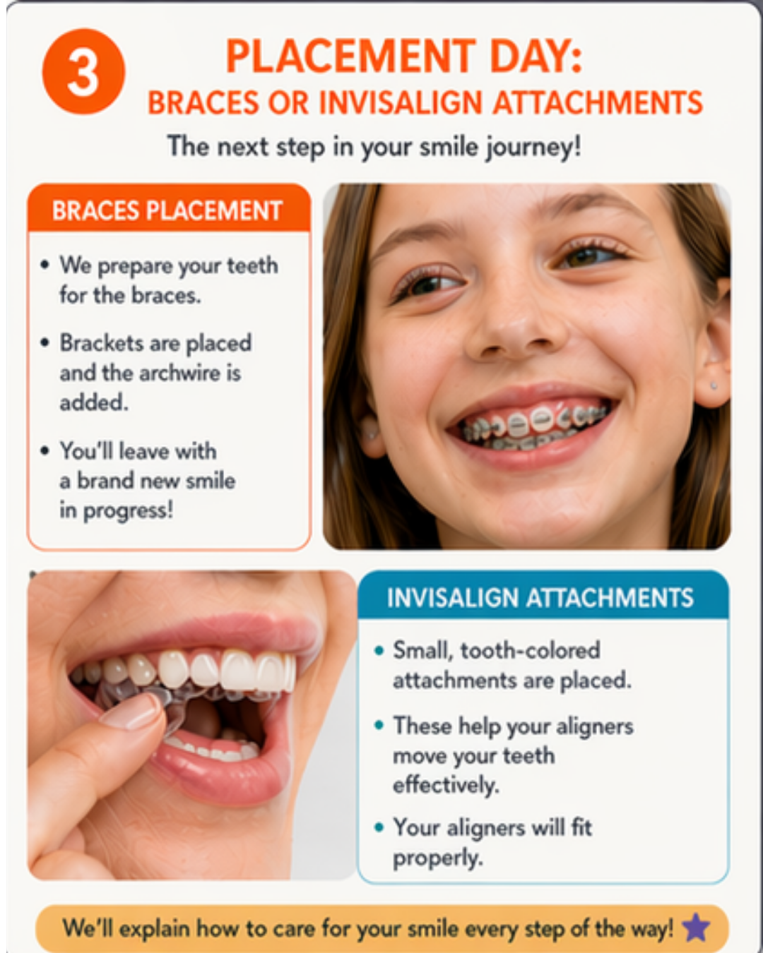 Placement of Braces or Invisalign Attachments