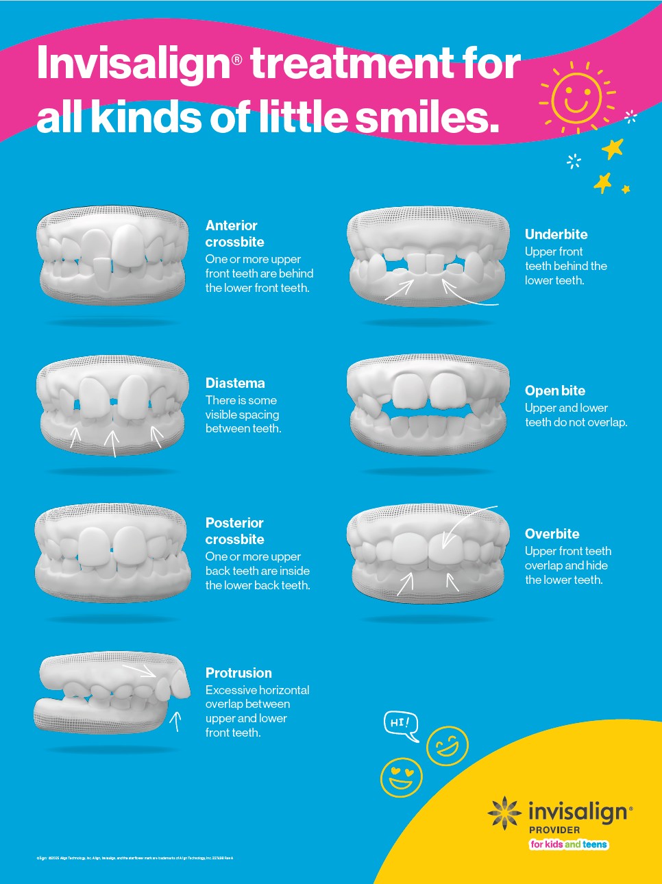 Reasons to use invisalign to correct these orthodontic problems